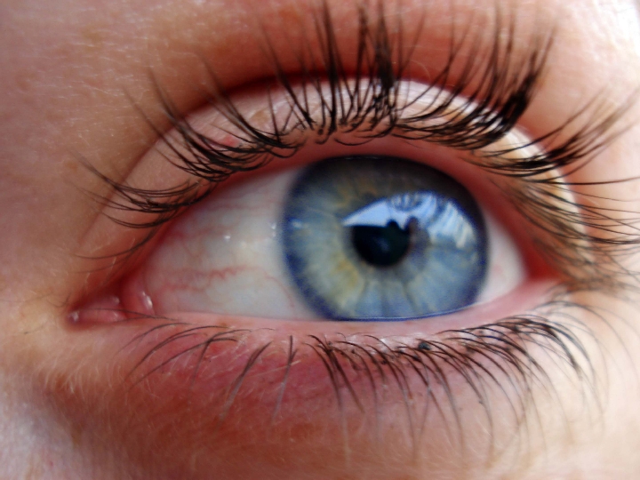 Laser procedure can turn brown eyes blue